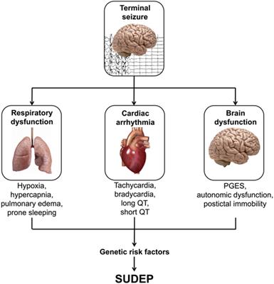 Genetic Basis of Sudden Unexpected Death in Epilepsy